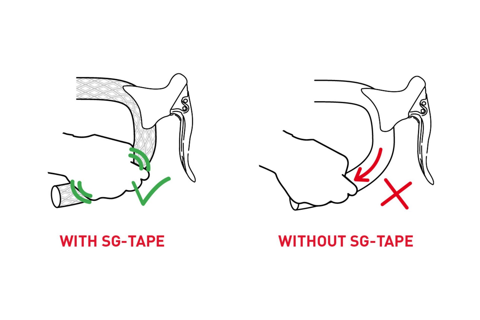 Selle Italia Shock Absorber Kit
